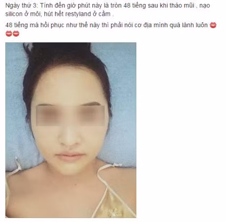 Loi khuyen gui chi em cua co gai Ha Noi vua tham my xong lai chiu dau de go het don cam, thao mui, nao silicon o moi - Anh 1