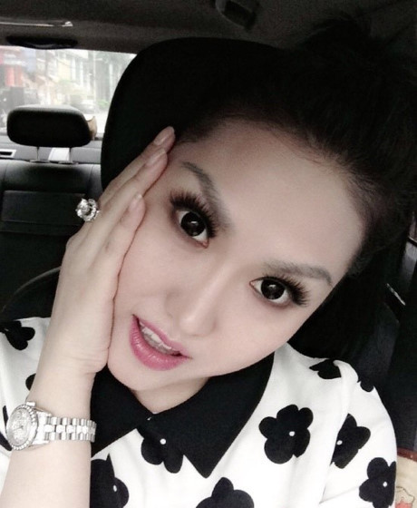 Tiet lo khoi tai san 