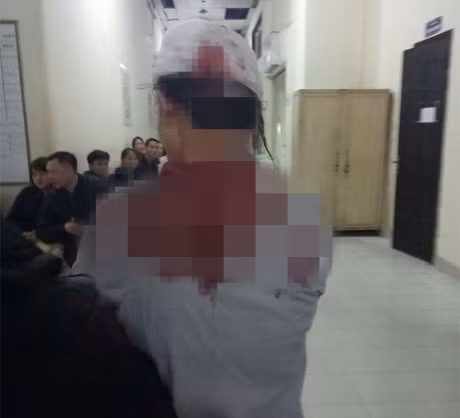 Cong an xac dinh 1 nghi can trong vu nu sinh bi danh nhap vien - Anh 2