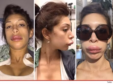 Bom moi va nhung he luy khon luong ma ban nen phong truoc - Anh 18