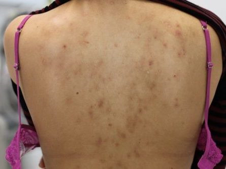 Giật mình với các hiểm họa Giat minh voi cac hiem hoa