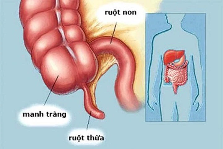 Ruột thừa rất quan trọng cho hệ tiêu hóa