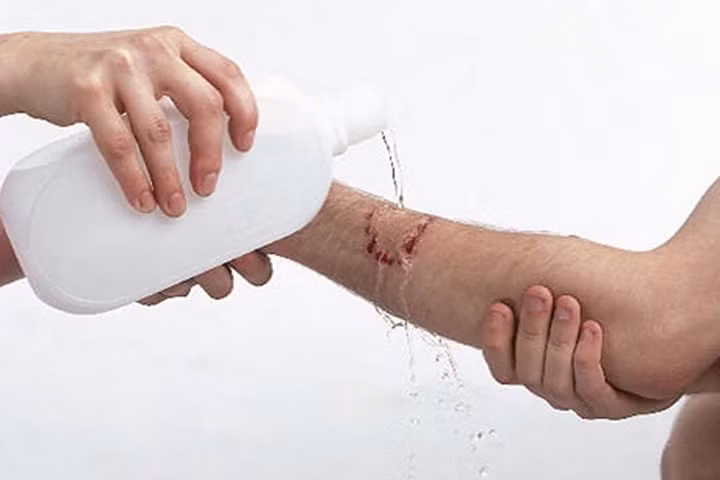 Khi nào không dùng ôxy già để sát khuẩn?