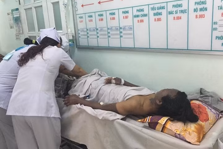 3 nhân viên quán bún bò bị phỏng nặng do rò khí gas