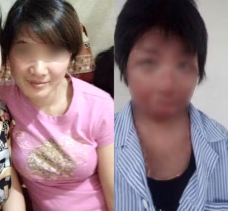 9X bi chong tuoi xang dot: 