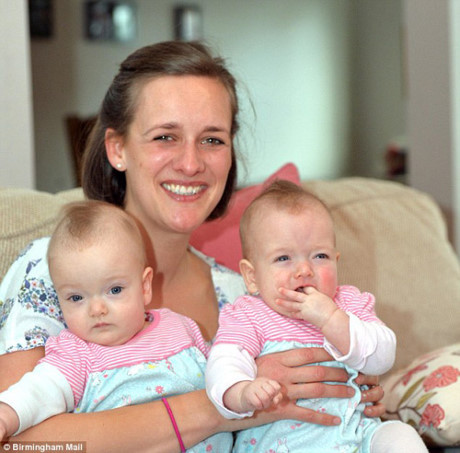 Khong ai ngo cap song sinh tuong chet trong bung me lai dang yeu the nay! - Anh 2