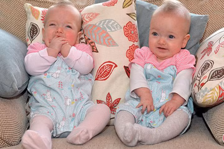 Cặp song sinh kháu khỉnh, đáng yêu đã từng trải qua ca phẫu thuật trong bụng mẹ.