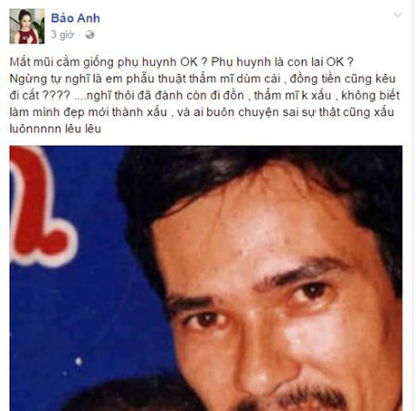 Bảo Anh tự tin khoe ảnh hồi nhỏ, phản pháo tin đồn nâng mũi - Ảnh 2 Bao Anh tu tin khoe anh hoi nho, phan phao tin don nang mui - Anh 2