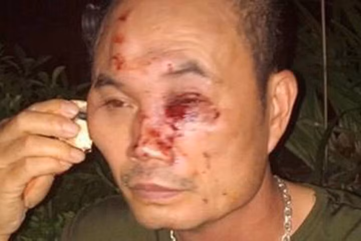 Nạn nhân của vụ hành hung tại Linh Đàm.