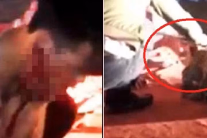 Tranh cãi vụ diễn viên bị cá sấu cắn rách mặt: Liều lĩnh hay tai nạn?