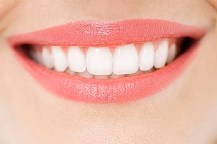 Cách lấy cao răng bằng dấm đơn giản, cực kì nhanh chóng