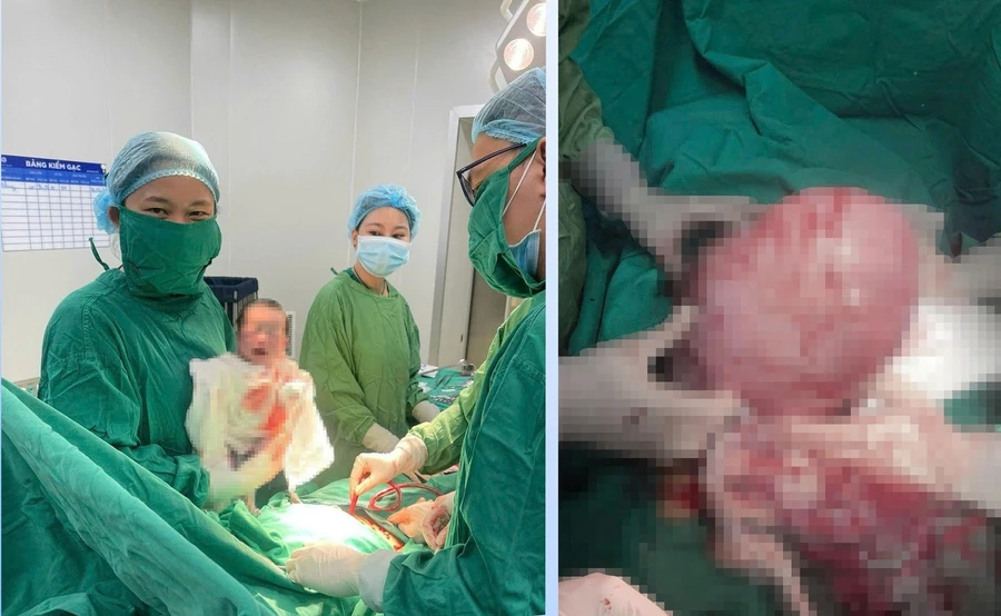 Bé trai nặng 2,6kg được chào đời khỏe mạnh sau khi các y bác sĩ thực hiện thành công ca phẫu thuật.