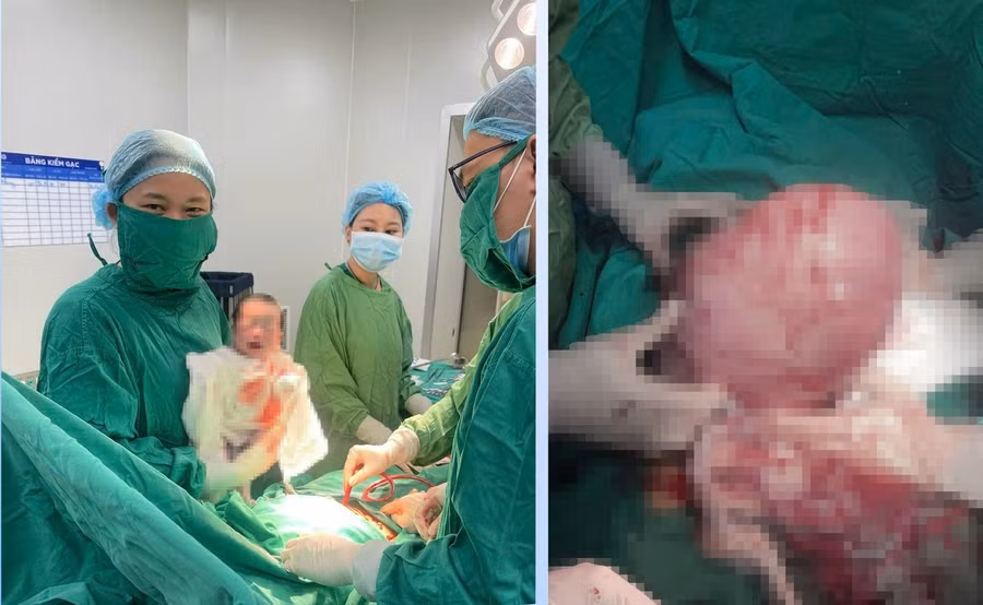 Bé trai nặng 2,6kg được chào đời khỏe mạnh sau khi các y bác sĩ thực hiện thành công ca phẫu thuật.