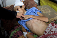 chum-anh-nan-doi-ngay-cang-nghiem-trong-o-dai-gaza-0705-02.jpg