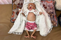 chum-anh-nan-doi-ngay-cang-nghiem-trong-o-dai-gaza-0705-07.jpg