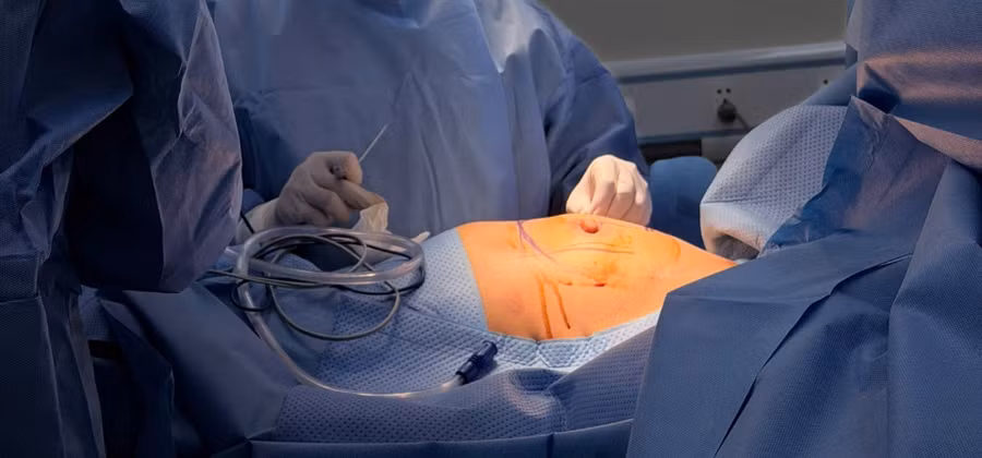 Bệnh nhân được phẫu thuật hai lần. 