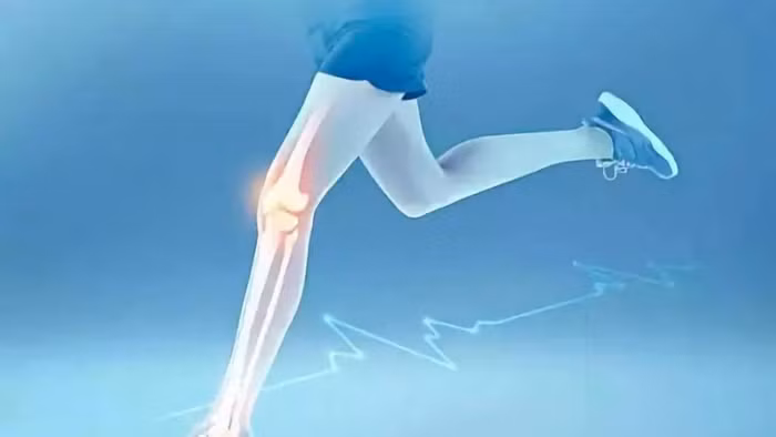 Bệnh nhân loãng xương dễ bị gãy xương, gây ảnh hưởng nghiêm trọng đến sức khỏe và cuộc sống. (Ảnh: ITN).