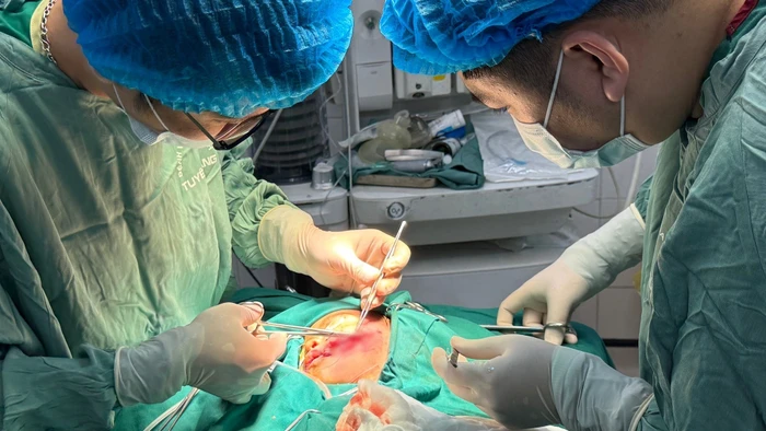Bác sĩ tiến hành phẫu thuật cho bệnh nhi bị chó cắn. Ảnh: BVĐK tỉnh Tuyên Quang
