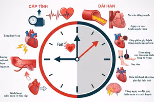Infographic: Biến chứng tim mạch của việc hút thuốc lá 