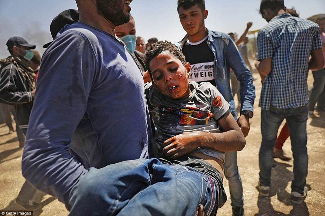 Một em nhỏ bị ảnh hưởng của hơi cay trong cuộc xung đột trên dải Gaza