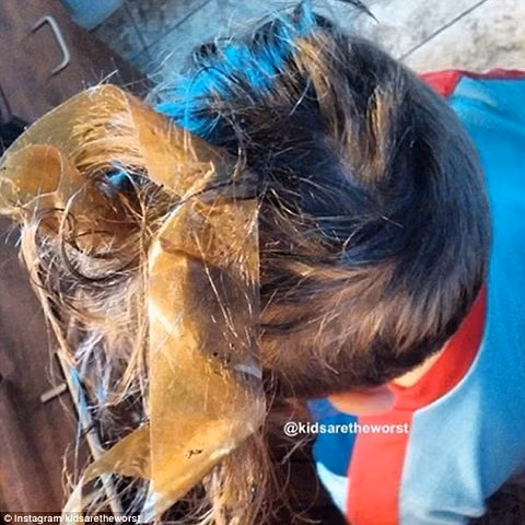 Bố mẹ ơi con bị dính băng vào tóc rồi