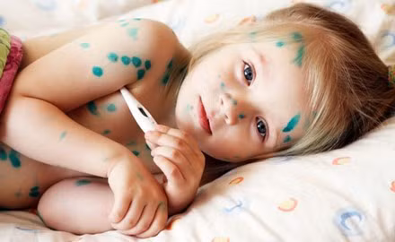 10 loai benh nguy hiem thuong gap vao mua he - Anh 7