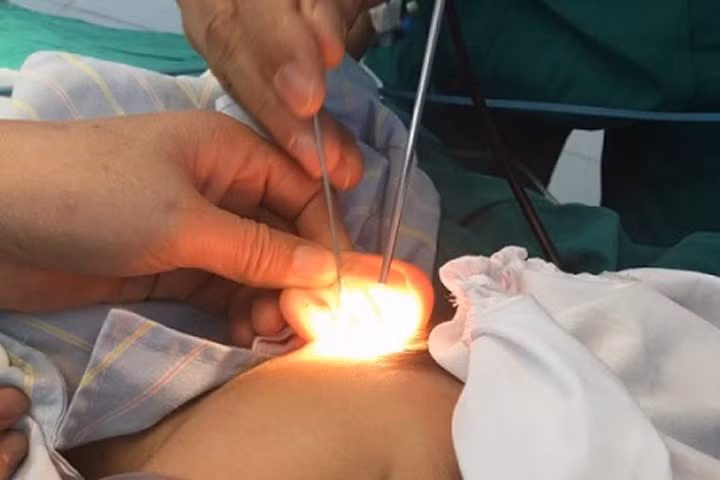 Trẻ có thể gặp nguy hiểm tính mạng vì đồ chơi do bất cẩn