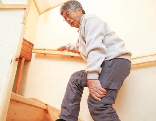 Bệnh xương khớp. 