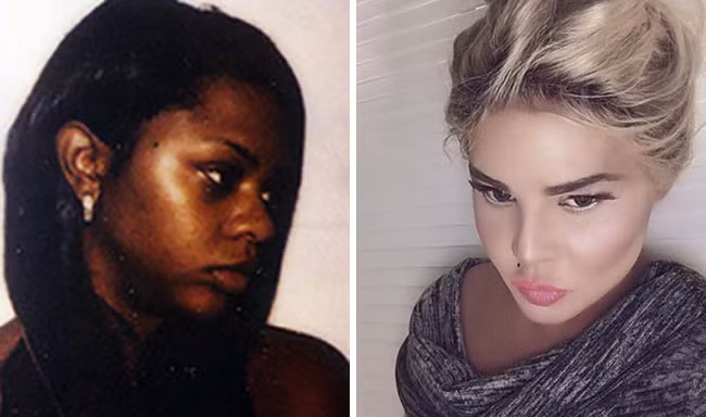 Nữ ca sĩ da đen gây sốc khi biến thành gái da trắng