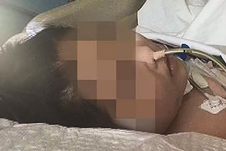 Cảnh báo nguy hiểm khi dùng răng mở nắp chai nước hoa quả ngâm