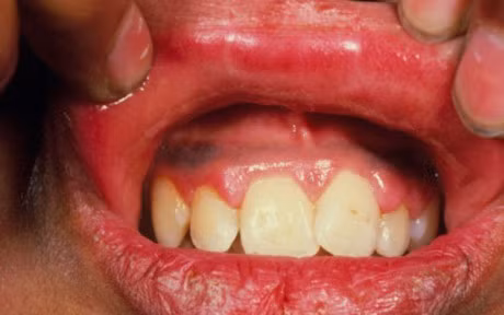 Thuc hu viec thai doc chi o spa lam dep? - Anh 2