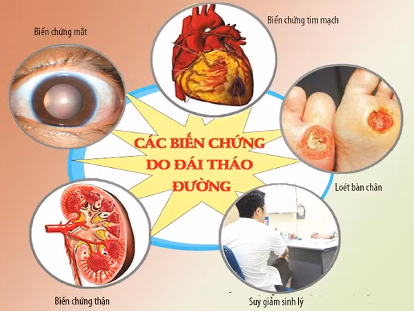 10 cách phòng biến chứng đái tháo đường