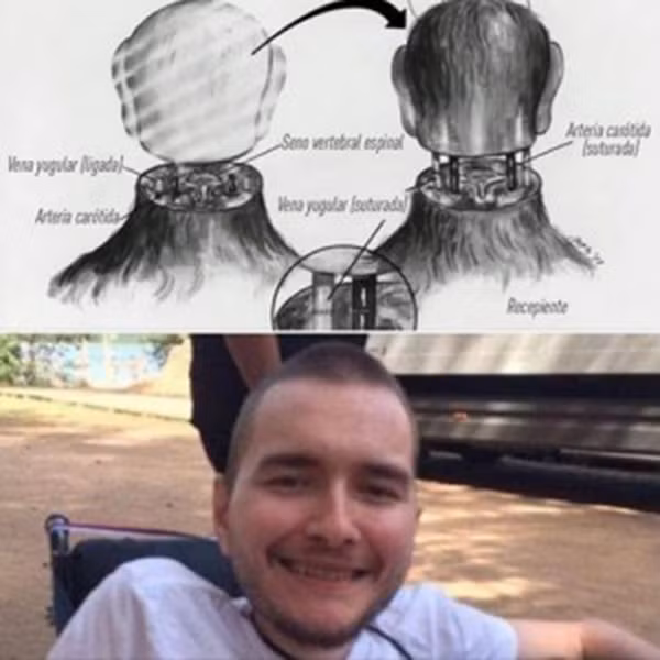 Tình nguyện chặt đầu cho ca phẫu thuật ghép đầu thử nghiệm