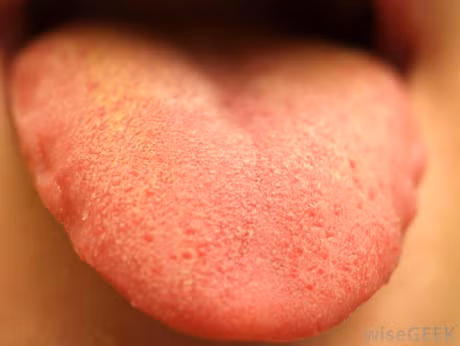 Mau sac cua luoi canh bao mot so benh - Anh 3