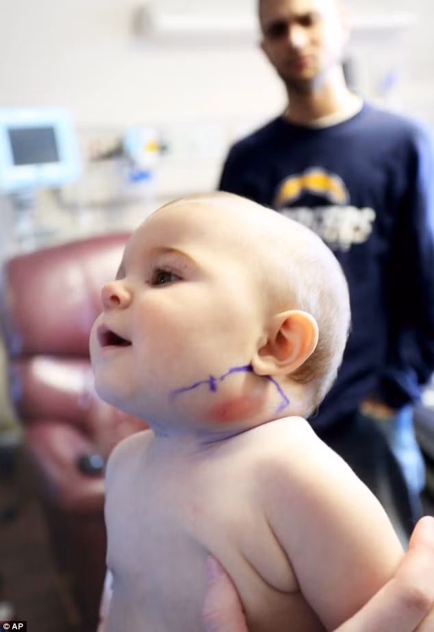 Mẹ tá hỏa khi phát hiện ra con mình mọc lông chim ở cằm