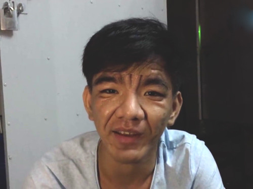 Kỳ lạ thanh niên 23 tuổi bỗng dưng biến thành ông lão - 1