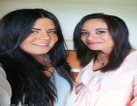 Nữ sinh xinh xắn Tiarne (trái) lúc chưa mắc bệnh