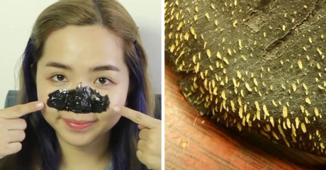 Công thức miếng dán lột hàng trăm nhân mụn đầu đen siêu rẻ và đơn giản - Ảnh 6 Cong thuc mieng dan lot hang tram nhan mun dau den sieu re va don gian - Anh 6