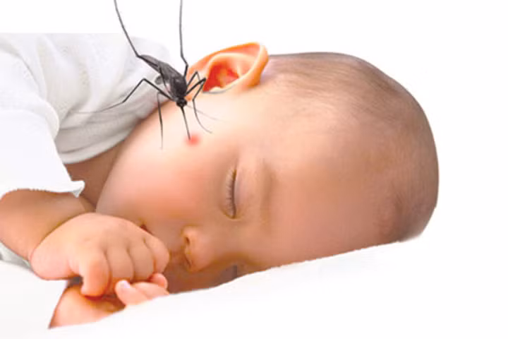 Mẹo nhỏ giúp vết muỗi đốt của bé giảm sưng, hết ngứa ngay lập tức