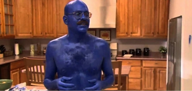 10 căn bệnh hiếm gặp ít người biết tới - Ảnh 2 10 căn bệnh hiếm gặp ít người biết tới - Ảnh 2