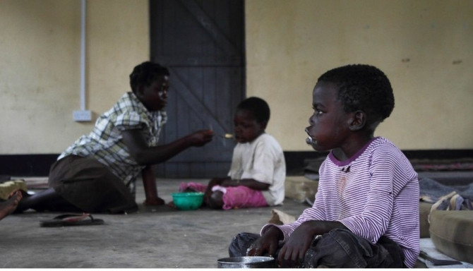 10 căn bệnh hiếm gặp ít người biết tới - Ảnh 5 10 căn bệnh hiếm gặp ít người biết tới - Ảnh 5