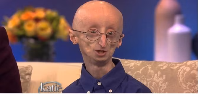 10 căn bệnh hiếm gặp ít người biết tới - Ảnh 3