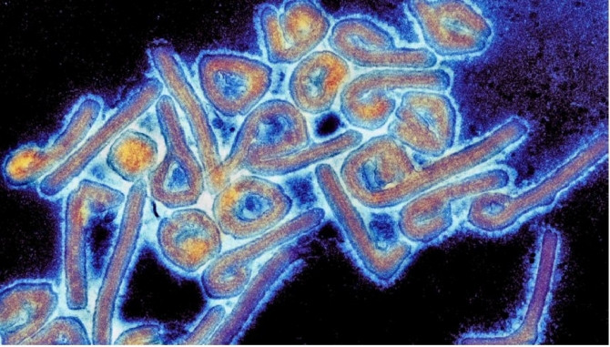 10 căn bệnh hiếm gặp ít người biết tới - Ảnh 9 10 căn bệnh hiếm gặp ít người biết tới - Ảnh 9