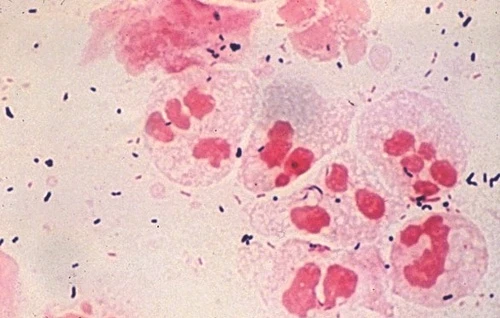 Chlamydia trachomatis