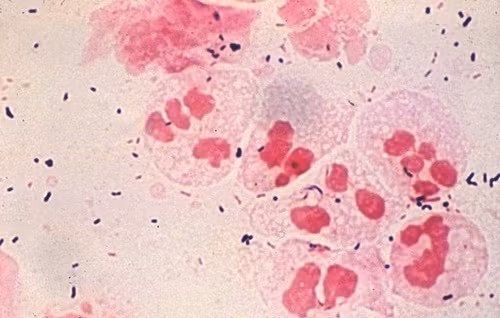 Chlamydia trachomatis