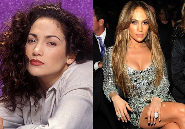 “Sao” trước và sau khi nổi tiếng ảnh 11 Jennifer Lopez