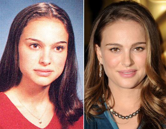 “Sao” trước và sau khi nổi tiếng ảnh 2 Natalie Portman