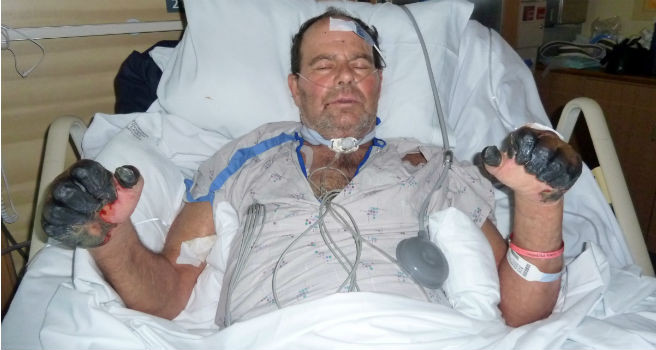 Bệnh dịch hạch bùng phát tại Madagascar. Bệnh dịch hạch bùng phát tại Madagascar.