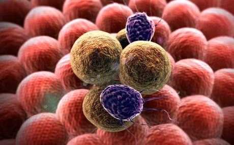 Bac si benh vien Viet Duc khuyen 6 dieu nen lam ngay de benh ung thu khong go cua - Anh 1