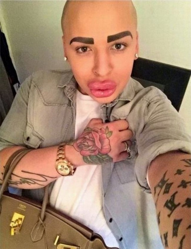 Jordan James Parke là anh chàng làm nghề trang điểm đến từ Anh. Chàng trai cực kì thần tượng cô Kim "siêu vòng 3" vì vậy đã quyết tâm phẫu thuật để có được vẻ ngoài giống Kim. Tuy nhiên anh chàng lại hơi "quá tay" với phần lông mày được xăm, tô quá đậm và môi được bơm căng. quý ông thẩm mỹ